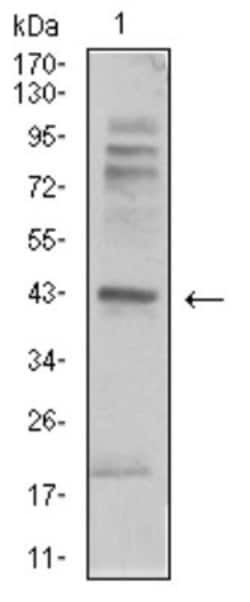 beta-2 Adrenergic R/ADRB2 Antibody (5G3B5) - BSA Free, Novus Biologicals